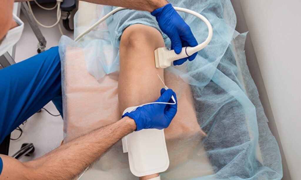 radiofrequency ablation knee melbourne